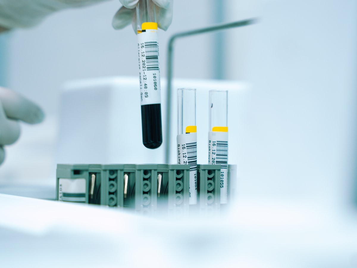 Blood sample tubes in a diagnostic laboratory